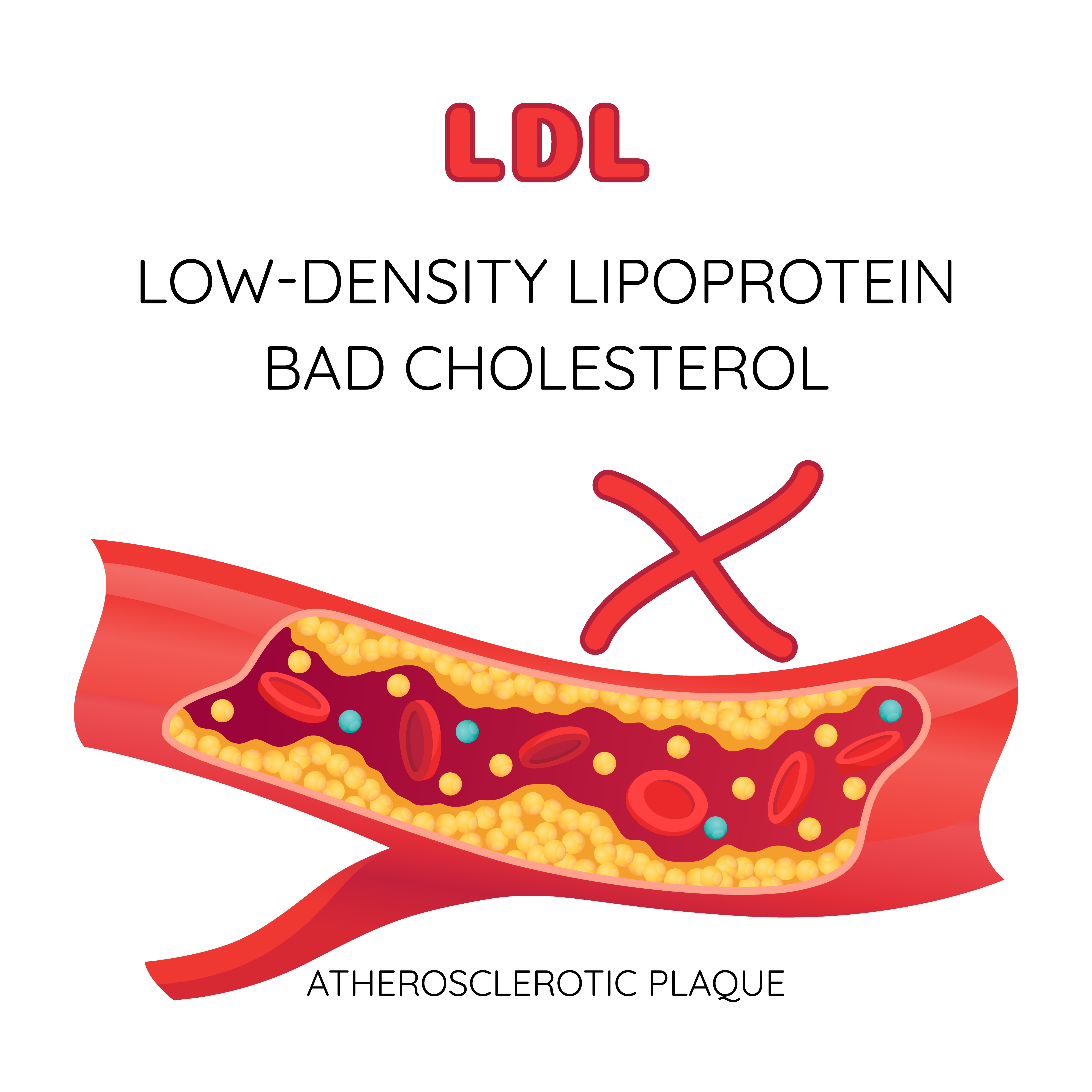 ไขมันไม่ดี LDL