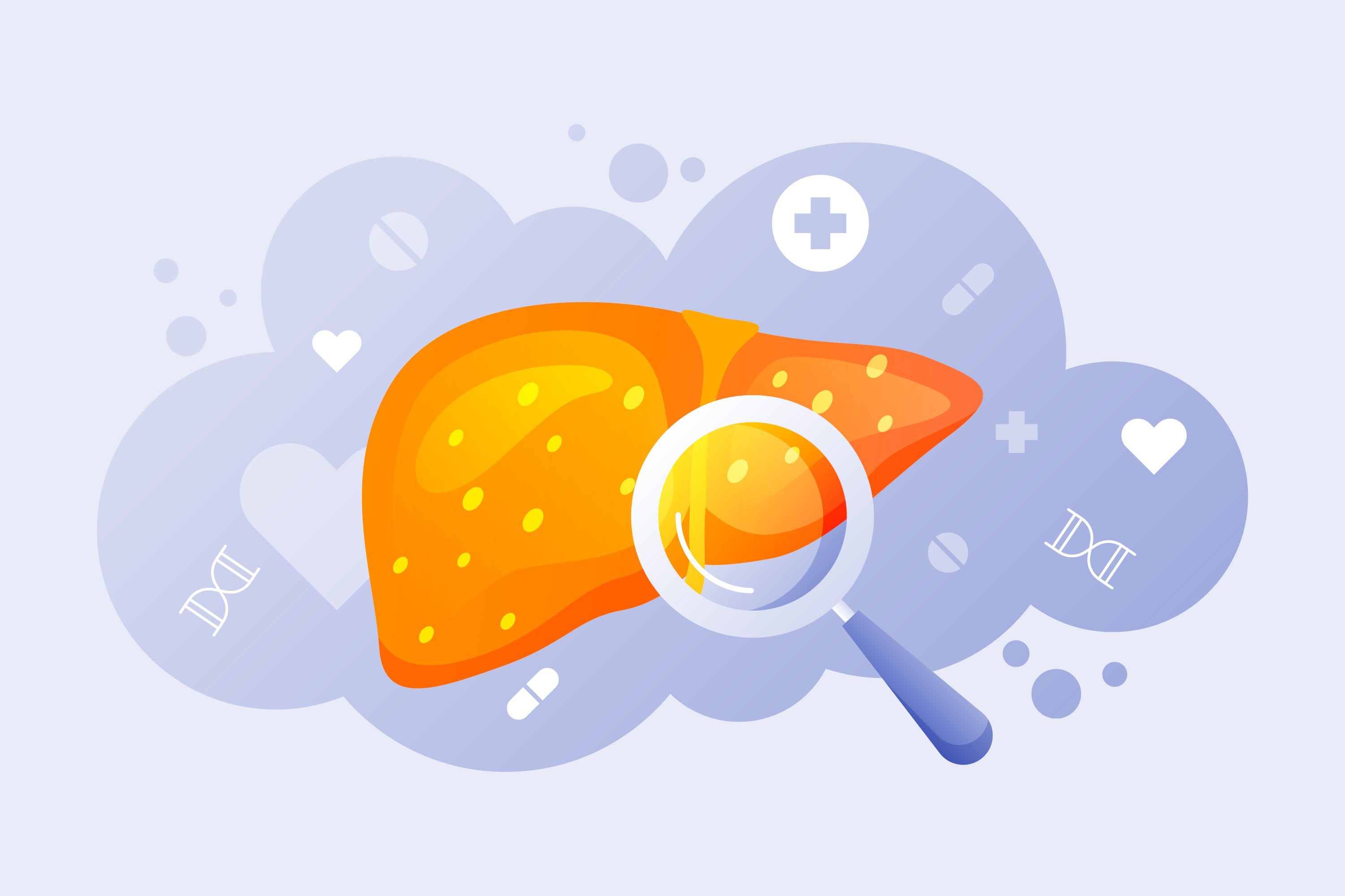 โรคไขมันพอกตับ